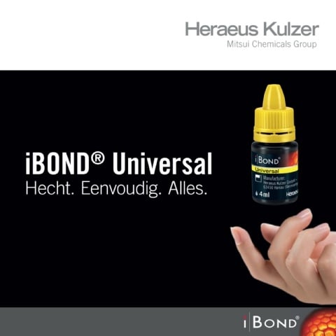 ibond universal