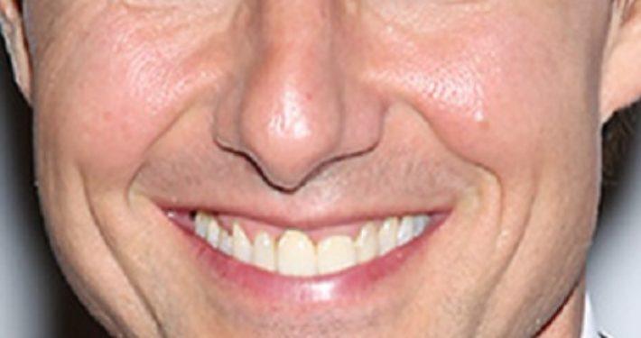 Orthodontische esthetiek