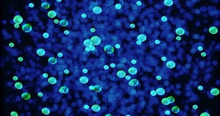 infectiepreventie