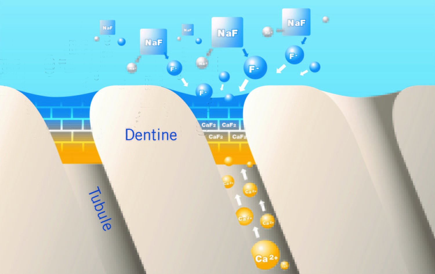 Profluorid Varnish Lak voor de desensibilisering van gevoelige tanden