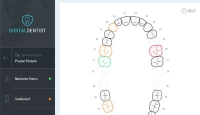 Prognosetool Digital Dentist nu online in App Store