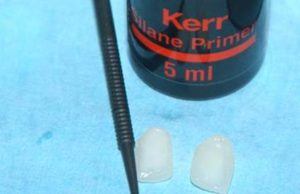 Silane Primer, Kerr