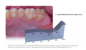 Implantaten en parodontium: zekerheid of risico?