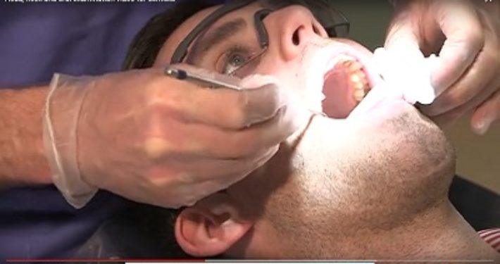 Gratis mondkanker onderzoek tijdens Mouth Cancer Awareness Day in Ierland
