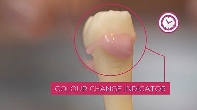 Esthetische indirecte restauraties vereenvoudigd dankzij MAXCEM ELITE™ CHROMA! Esthetische indirecte restauraties vereenvoudigd dankzij MAXCEM ELITE™ CHROMA!