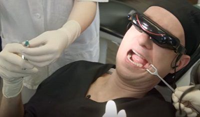 Beraadslagen Plakken waarde Implantoloog plaatst implantaat bij zichzelf - dental INFO