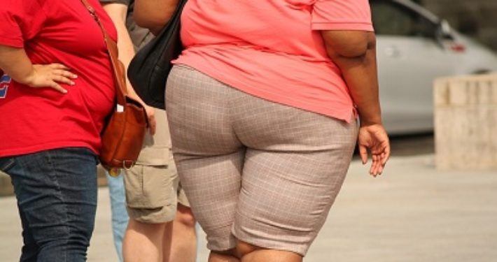 obesitas