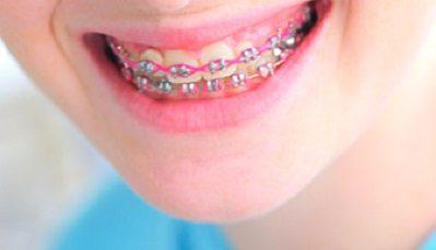 orthodontische