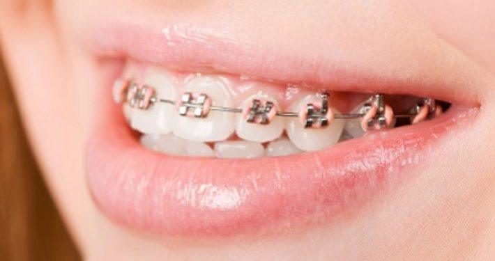 Tandarts voor orthodontie: duidelijkheid in titelaanduiding