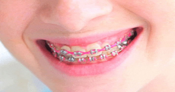 Orthodontist mag geen contact met vrouwelijke patiënten hebben