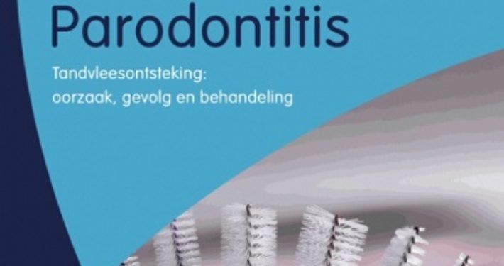 pardontitis