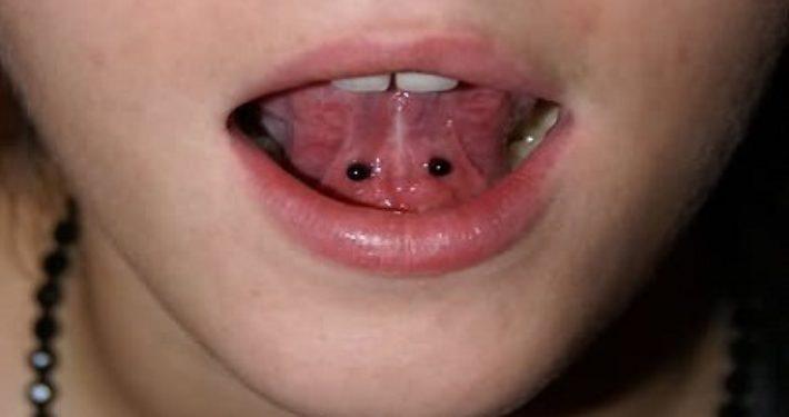 mondpiercing