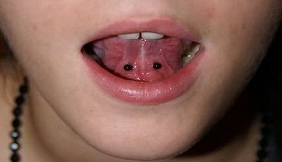 mondpiercing