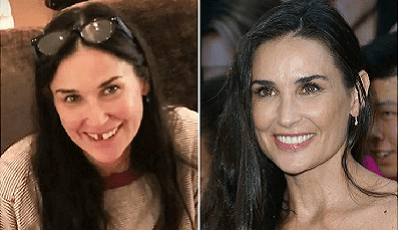 Demi moore tandverlies door stress