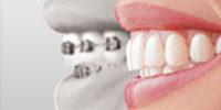 Vacature mondhygiënist in Kollum, Friesland