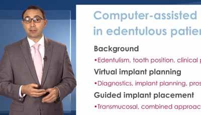Computer-geassisteerde implantaatplanning voor edentate patiënten