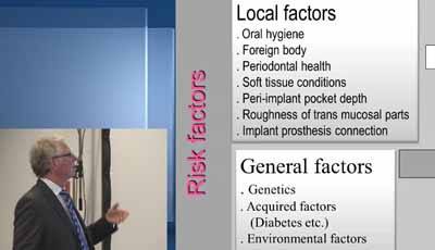Peri-implantitis – Deel 4: Risicofactoren