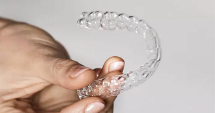 Orthodontie zonder bezoek met teleorthodontie