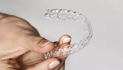 Orthodontie zonder bezoek met teleorthodontie