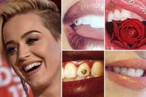 Ook tanden krijgen een eigen trend: “tooth gems”