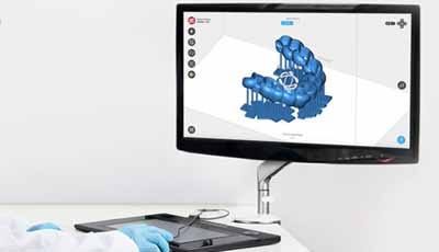 3D printen in de tandheelkunde. Waar hebben we het eigenlijk over?