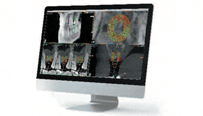 Acteon® X-MIND Trium en Piezotome Cube