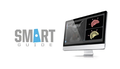 Campus SMART Guide: voor computergestuurde chirurgie en driedimensionale implantologie planning