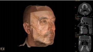 3D Facial Scanning