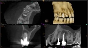 Endodontics