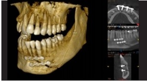 Oral and Maxillofacial Surgery