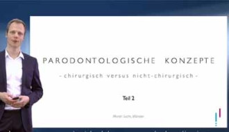 Parodontologische concepten – Wel of geen parodontale chirurgie? (Nederlands ondertiteld)