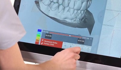 https://www.dentalinfo.nl/thema-a-z/rontgen-digitale-tandheelkunde/modjaw-jaw-motion-tracker-system/