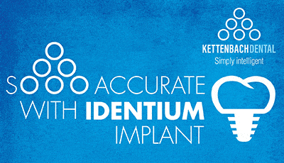 Identium® als afdrukmateriaal voor de implantaat afdruk