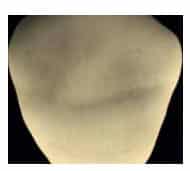 Voco profluorid 