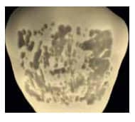 Voco profluorid