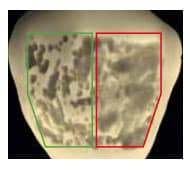 Voco profluorid 