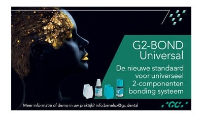 G2-BOND Universal van GC