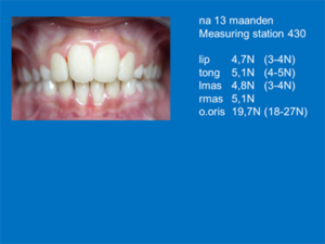 Resultaat-Hussain-13-maanden