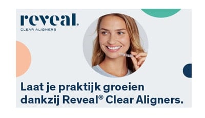 Reveal Clear Aligners