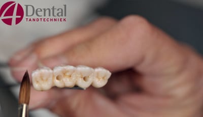 4Dental-tandtechniek