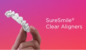 SureSmile-Clear-Aligners