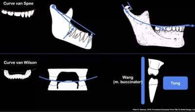 Video: Casuspresentatie - Stabiliteit na orthodontie