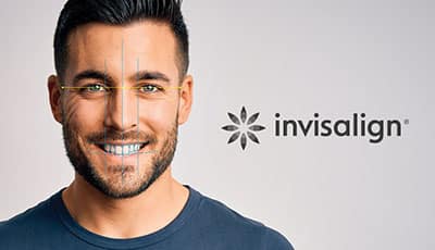 Invisalign