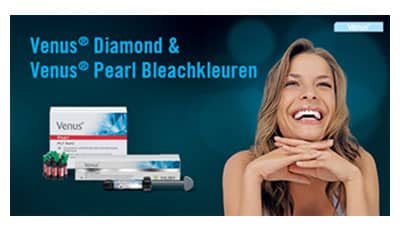 Venus Diamond & Venus Pearl Bleachkleuren – Een perfect witte glimlach, zonder bleken witrand