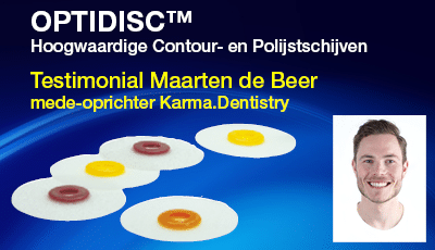 Testimonial Maarten de Beer: OptiDisc™ contour- en polijstschijfjes