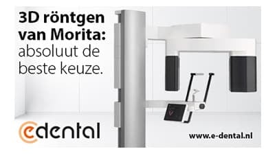 Morita veraview 3D 400 x 230 met witrand