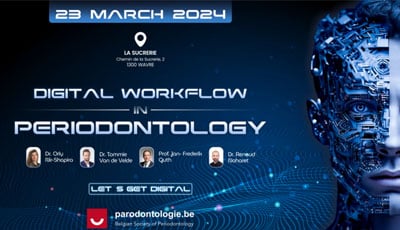 Let’s get digital Digital work-flow in Periodontology