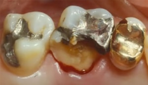 8. breuk van het element door een gebrek aan afsteuning en overbelasting