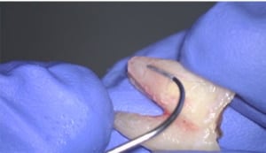 9.Het parodontale ligament.