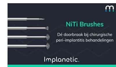 niti brushes met witrand